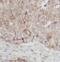 SRC Proto-Oncogene, Non-Receptor Tyrosine Kinase antibody, FNab02028, FineTest, Immunohistochemistry paraffin image 