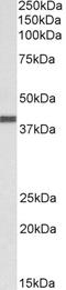 C-X-C Motif Chemokine Receptor 1 antibody, STJ73074, St John