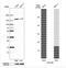 Nucleoporin 155 antibody, NBP1-82960, Novus Biologicals, Western Blot image 