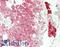 STK11 antibody, LS-B14816, Lifespan Biosciences, Immunohistochemistry paraffin image 