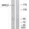 Mannose Receptor C Type 2 antibody, A04070, Boster Biological Technology, Western Blot image 