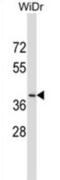Dual Oxidase Maturation Factor 2 antibody, abx027391, Abbexa, Western Blot image 