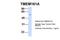 Transmembrane Protein 161A antibody, NBP1-91304, Novus Biologicals, Western Blot image 