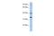 Testis Expressed 264, ER-Phagy Receptor antibody, A15581, Boster Biological Technology, Western Blot image 