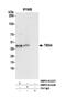 Thioredoxin Related Transmembrane Protein 4 antibody, NBP2-61227, Novus Biologicals, Immunoprecipitation image 