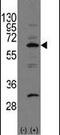 NEDD8 Activating Enzyme E1 Subunit 1 antibody, PA5-14138, Invitrogen Antibodies, Western Blot image 