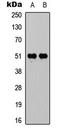 Vitamin D Receptor antibody, LS-C358389, Lifespan Biosciences, Western Blot image 