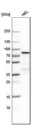 Bruton Tyrosine Kinase antibody, HPA001198, Atlas Antibodies, Western Blot image 