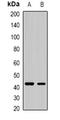 Sorting Nexin 32 antibody, orb341420, Biorbyt, Western Blot image 