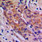 Phosphatidylinositol-4,5-Bisphosphate 3-Kinase Catalytic Subunit Alpha antibody, LS-C352657, Lifespan Biosciences, Immunohistochemistry paraffin image 