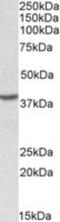 Poly(rC)-binding protein 1 antibody, NBP1-52113, Novus Biologicals, Western Blot image 