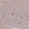 Clavesin 2 antibody, HPA043764, Atlas Antibodies, Immunohistochemistry frozen image 