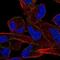 ALK Receptor Tyrosine Kinase antibody, NBP2-48518, Novus Biologicals, Immunocytochemistry image 