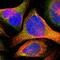 T Cell Leukemia Translocation Altered antibody, NBP1-86497, Novus Biologicals, Immunocytochemistry image 