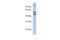 Enhancer Of Zeste 1 Polycomb Repressive Complex 2 Subunit antibody, PA5-40850, Invitrogen Antibodies, Western Blot image 