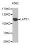 Large Tumor Suppressor Kinase 1 antibody, abx005402, Abbexa, Western Blot image 