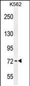 P21 (RAC1) Activated Kinase 6 antibody, PA5-35107, Invitrogen Antibodies, Western Blot image 