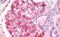 Tyrosyl-DNA Phosphodiesterase 2 antibody, MBS248249, MyBioSource, Immunohistochemistry paraffin image 