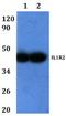 Interleukin 1 Receptor Type 2 antibody, A03106, Boster Biological Technology, Western Blot image 