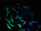 Corticotropin Releasing Hormone Receptor 1 antibody, LS-C285481, Lifespan Biosciences, Immunofluorescence image 