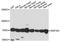 Zinc Finger Protein 333 antibody, A13839, Boster Biological Technology, Western Blot image 