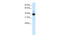 Tetratricopeptide Repeat Domain 19 antibody, 29-197, ProSci, Western Blot image 