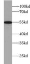 TRNA Methyltransferase 2 Homolog B antibody, FNab09006, FineTest, Western Blot image 