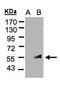 Feline Leukemia Virus Subgroup C Cellular Receptor 1 antibody, NBP2-16509, Novus Biologicals, Western Blot image 