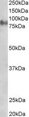 Junction Plakoglobin antibody, 45-076, ProSci, Western Blot image 