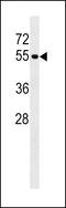 Protein Tyrosine Phosphatase Non-Receptor Type 18 antibody, LS-C162303, Lifespan Biosciences, Western Blot image 