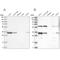 Interferon-inducible double stranded RNA-dependent protein kinase activator A antibody, NBP2-55123, Novus Biologicals, Western Blot image 