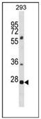 Pleckstrin Homology And FYVE Domain Containing 1 antibody, AP53348PU-N, Origene, Western Blot image 