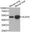 Aldehyde Dehydrogenase 2 Family Member antibody, abx001138, Abbexa, Western Blot image 