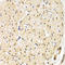 Telomeric Repeat Binding Factor 1 antibody, LS-C346079, Lifespan Biosciences, Immunohistochemistry paraffin image 