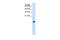 Cystatin-S antibody, A07438, Boster Biological Technology, Western Blot image 