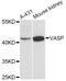 Vasodilator Stimulated Phosphoprotein antibody, LS-C749227, Lifespan Biosciences, Western Blot image 