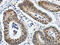 Kruppel Like Factor 5 antibody, CSB-PA234904, Cusabio, Immunohistochemistry paraffin image 