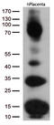 CD36 Molecule antibody, M01189-1, Boster Biological Technology, Western Blot image 