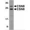 COP9 Signalosome Subunit 8 antibody, MBS150159, MyBioSource, Western Blot image 