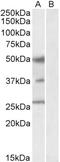 HNF-3A antibody, EB05999, Everest Biotech, Western Blot image 