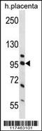 Nucleolin antibody, 57-876, ProSci, Western Blot image 