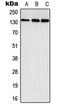 EPH Receptor A3 antibody, LS-C352160, Lifespan Biosciences, Western Blot image 