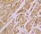 Interleukin 1 Receptor Associated Kinase 2 antibody, NBP2-76843, Novus Biologicals, Immunohistochemistry paraffin image 