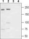 Sodium Voltage-Gated Channel Alpha Subunit 9 antibody, PA5-77738, Invitrogen Antibodies, Western Blot image 