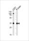 G Protein Subunit Alpha O1 antibody, 63-797, ProSci, Western Blot image 