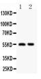 Histone Deacetylase 2 antibody, PA1350-2, Boster Biological Technology, Western Blot image 