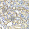ST3 Beta-Galactoside Alpha-2,3-Sialyltransferase 4 antibody, A6309, ABclonal Technology, Immunohistochemistry paraffin image 