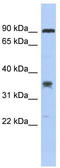 Leucine Rich Repeat Containing 73 antibody, TA334937, Origene, Western Blot image 