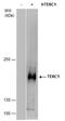 Tensin 2 antibody, PA5-21966, Invitrogen Antibodies, Western Blot image 