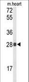 Tetraspanin 1 antibody, LS-C160260, Lifespan Biosciences, Western Blot image 